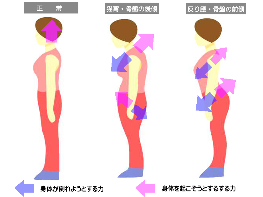 猫背や反り腰など軽度でも代償動作あると、姿勢保持にベクトルの調整が必要で運動能力が低下する