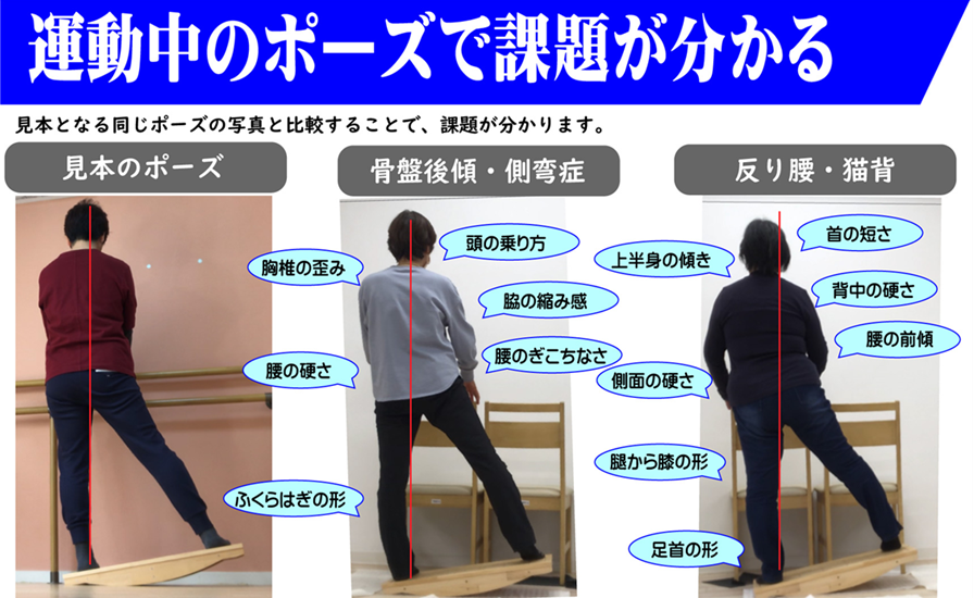正しい姿勢のアライメントに導くため、内股、外股、円背、猫背、骨盤の歪みなど全身の問題を知ることが重要