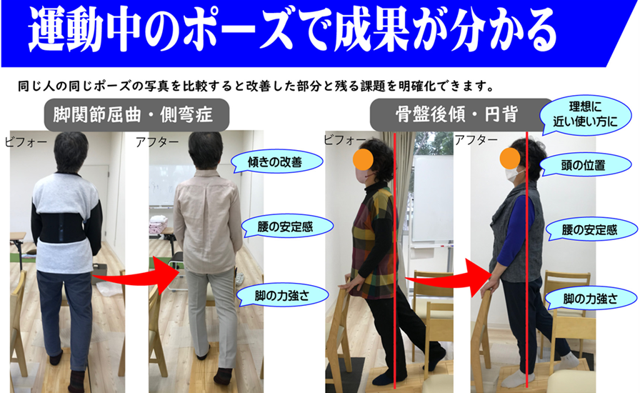 立位の姿勢分析と合わせて、トレーニング中のアライメントの比較で正常な関節可動域になったか確認できる
